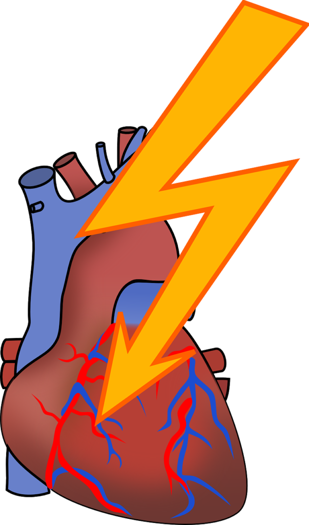 arrhythmia, heart attack, cardiac-156099.jpg