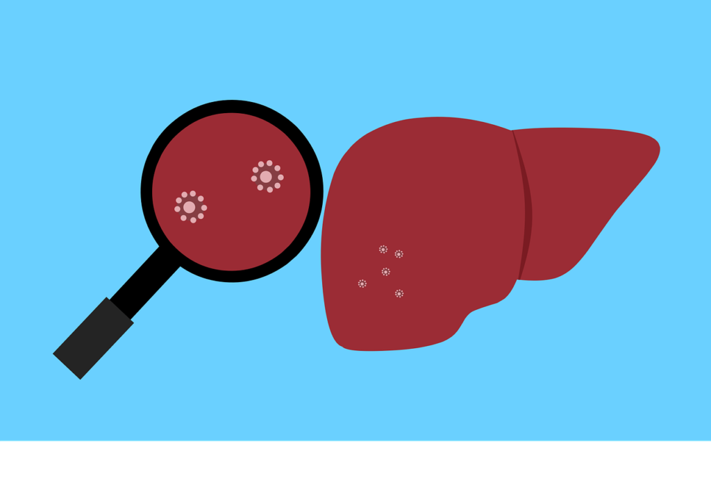 liver, bacteria, virus-5669876.jpg